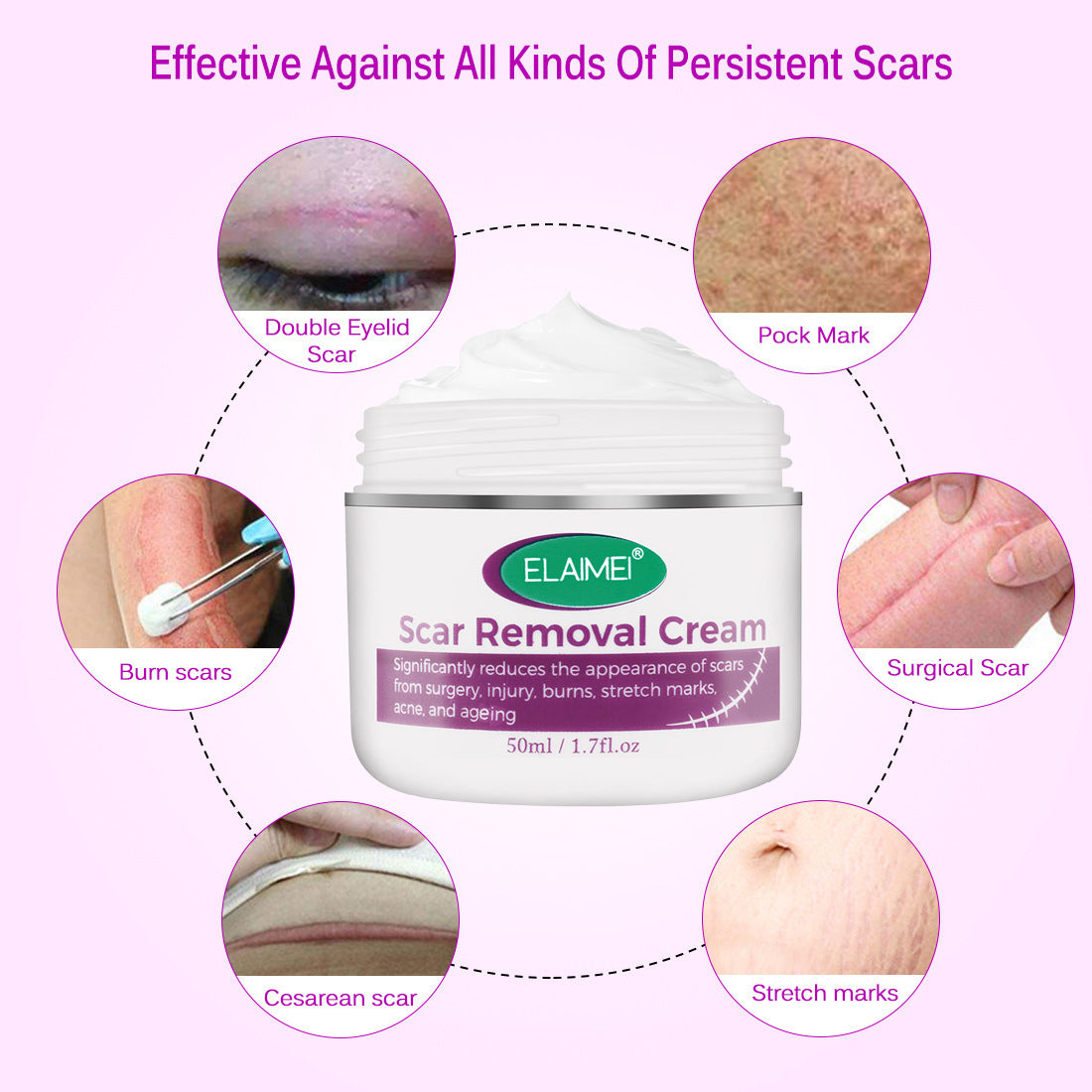 Skin Rebound Scarless Cream Scar
